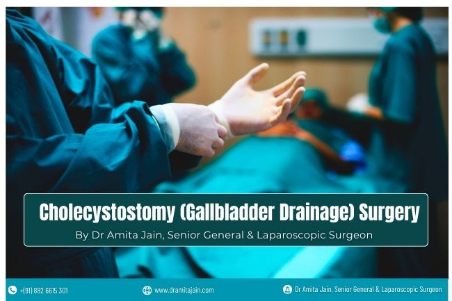 Cholecystostomy Gallbladder Drainage Surgeon Dr Amita Jain India Cholecystostomy Gallbladder Drainage Surgeon Dr Amita Jain India